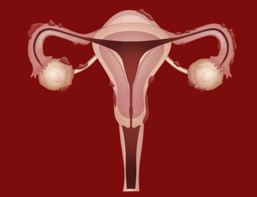 Endometriosis Treatment